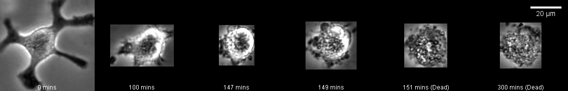 Images of cell death