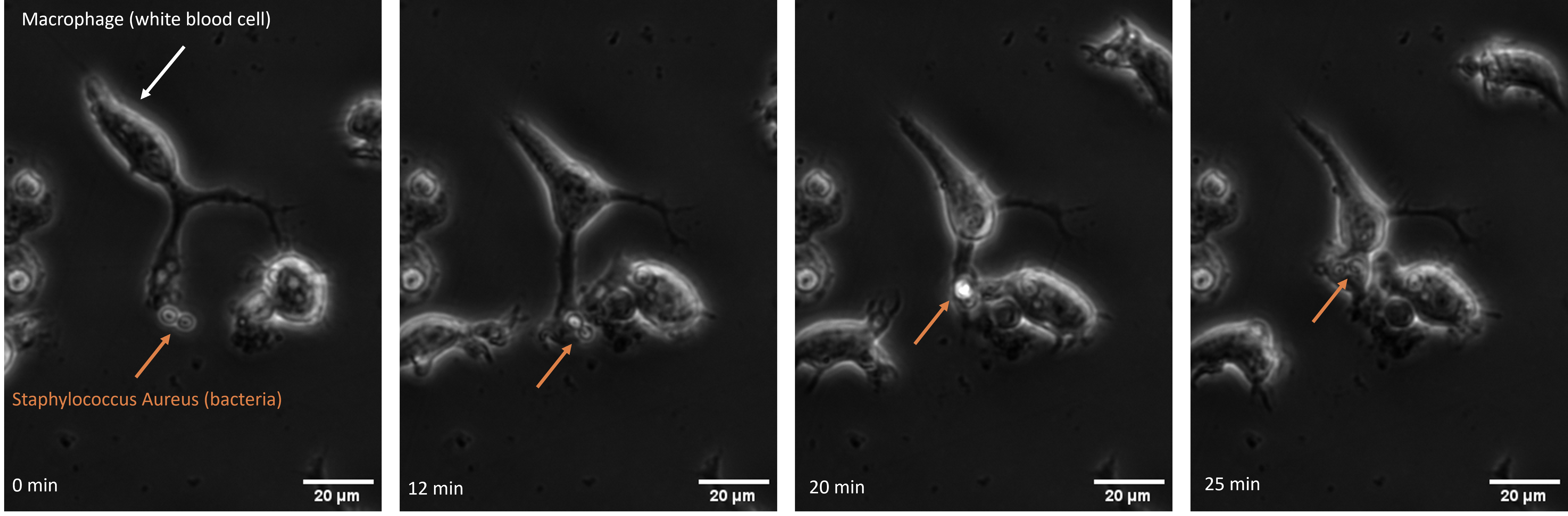 Phagocytosis